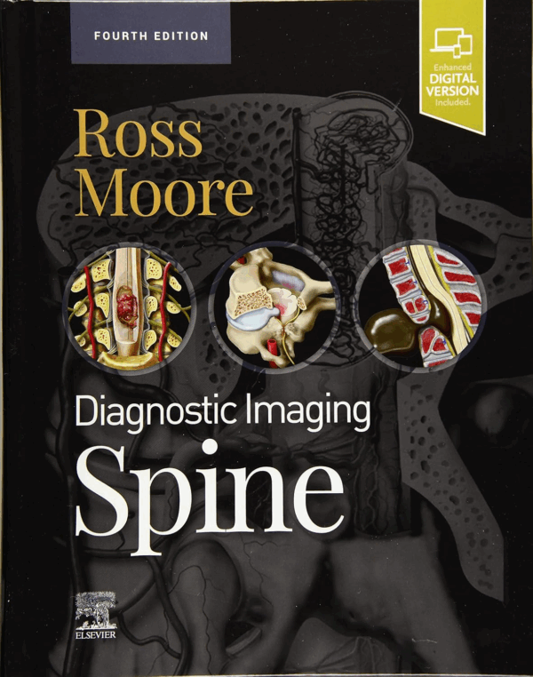 Diagnostic Imaging: Spine, 4th Edition