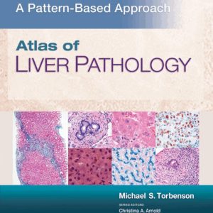 Atlas of Liver Pathology: A Pattern-Based Approach