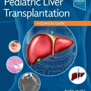 Pediatric Liver Transplantation, 1st Edition