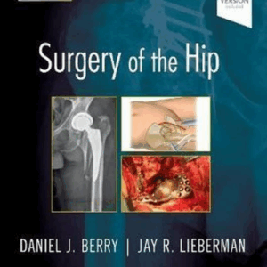 Surgery of the Hip, 2nd Edition