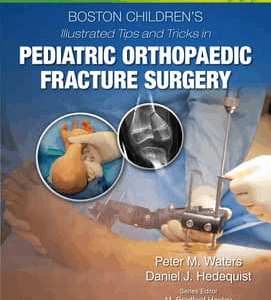 Boston Children’s Illustrated Tips and Tricks in Pediatric Orthopaedic Fracture Surgery