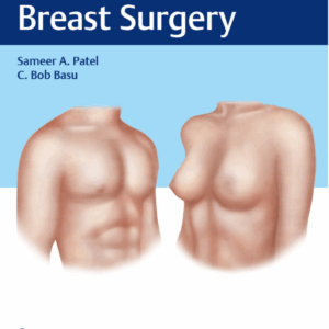 Cosmetic Breast Surgery, 1st Edition