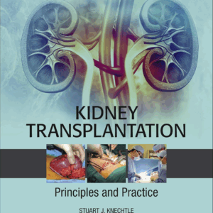 Kidney Transplantation - Principles and Practice, 8th Edition