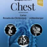 ExpertDDx: Chest, 2nd Edition