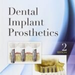 Dental Implant Prosthetics, 2nd Edition