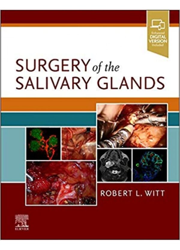 Surgery of the Salivary Glands, 1st Edition
