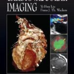 Cardiovascular Imaging