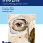 Endoscopic Surgery of the Orbit: Anatomy, Pathology, and Management 1st Edition
