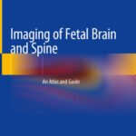 Imaging of Fetal Brain and Spine: An Atlas and Guide, 1st Edition