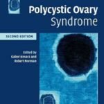 Polycystic Ovary Syndrome, 2nd Edition