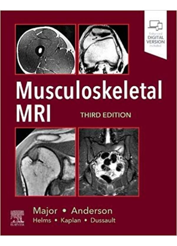 Musculoskeletal MRI, 3rd Edition