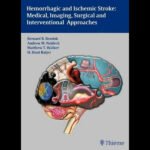 Hemorrhagic and Ischemic Stroke, 1st Edition