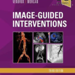 Image-Guided Interventions, 3rd Edition
