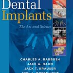 Dental Implants, 2nd Edition