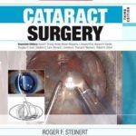 Cataract Surgery, 3rd Edition