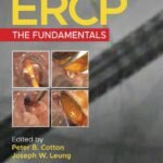 ERCP: The Fundamentals, 3rd Edition