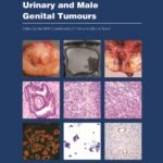 Urinary and Male Genital Tumours WHO Classification of Tumours, 5th Edition, Volume 8