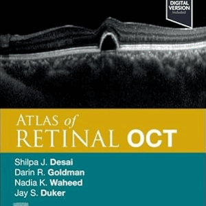 Atlas of Retinal OCT, 2nd Edition