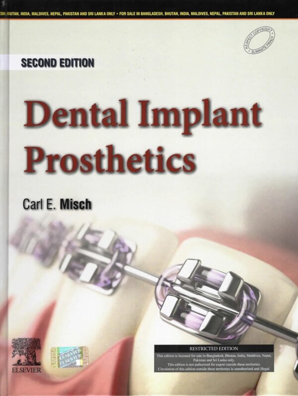 Dental Implant Prosthetics, 2nd Indian Edition, 2024
