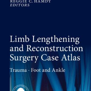 Limb Lengthening and Reconstruction Surgery Case Atlas: Trauma • Foot and Ankle, 1st Edition