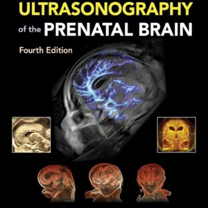 Timor's Ultrasonography of the Prenatal Brain, 4th Edition