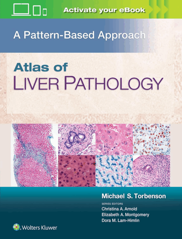 Atlas of Liver Pathology: A Pattern-Based Approach - Mehul Traders