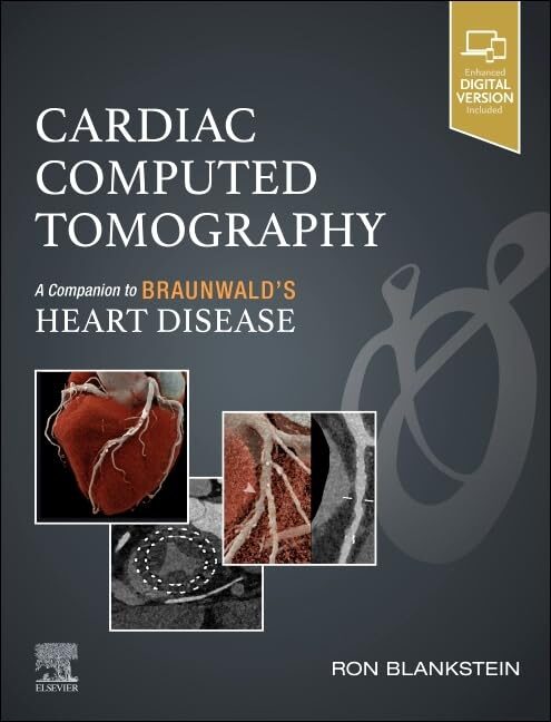 Cardiac Computed Tomography, 1st Edition 1 Cardiac Computed Tomography, 1st Edition
