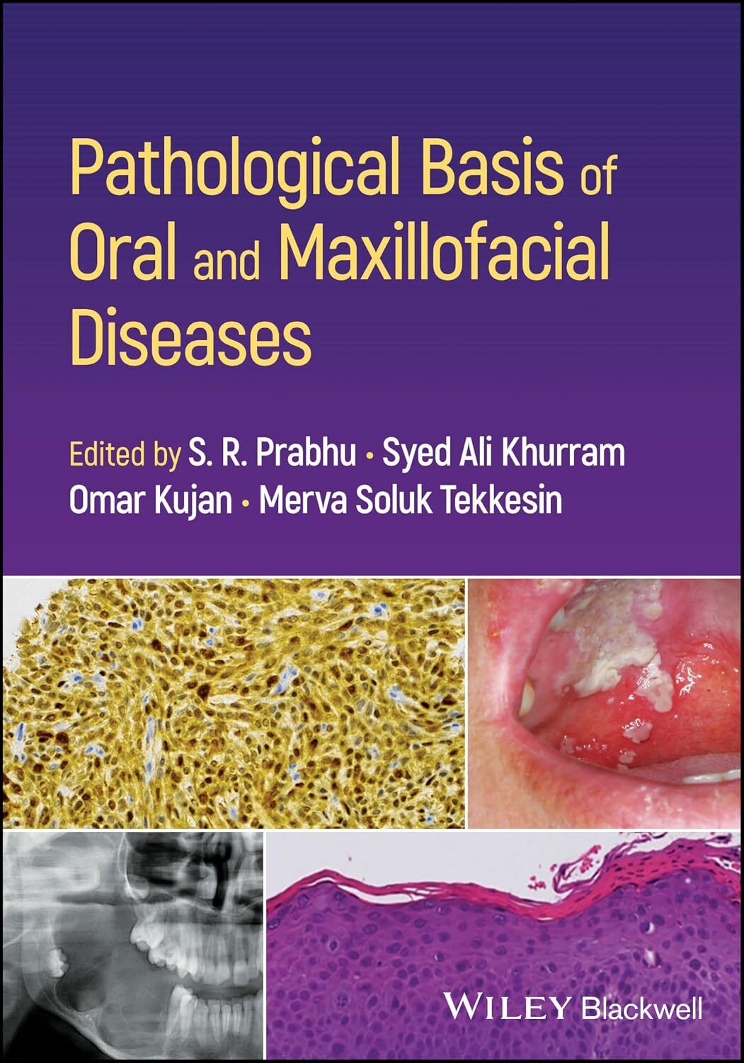 Pathological Basis of Oral and Maxillofacial Diseases, 1st Edition 1 Pathological Basis of Oral and Maxillofacial Diseases, 1st Edition
