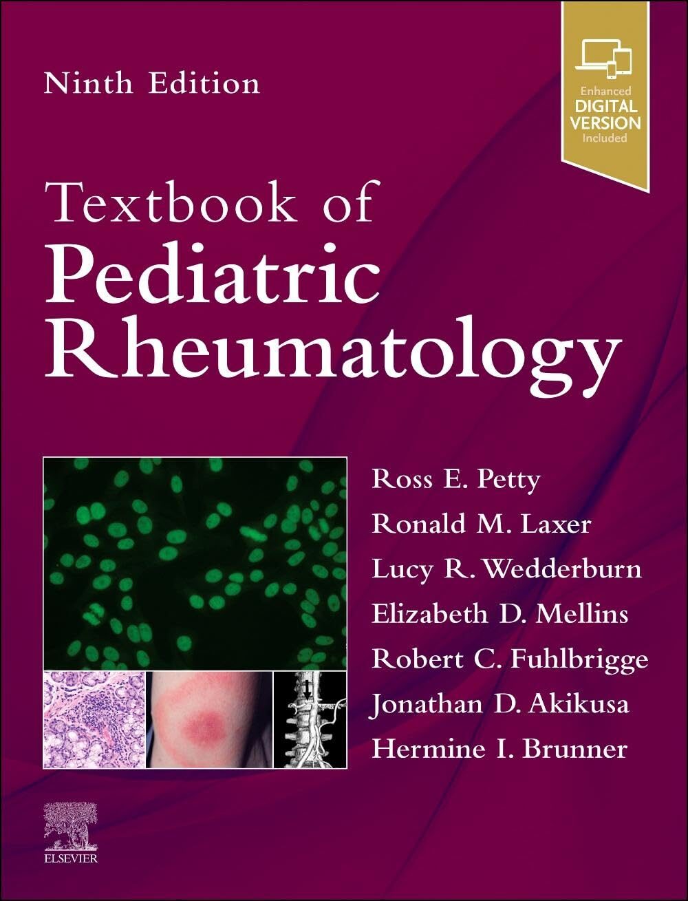 Textbook of Pediatric Rheumatology, 9th Edition 1 Textbook of Pediatric Rheumatology, 9th Edition